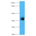 cpg2 Polyclonal Antibody from Signalway Antibody (42637) - Antibodies.com