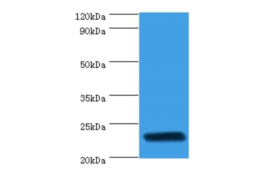 rpiA Polyclonal Antibody from Signalway Antibody (42640) - Antibodies.com