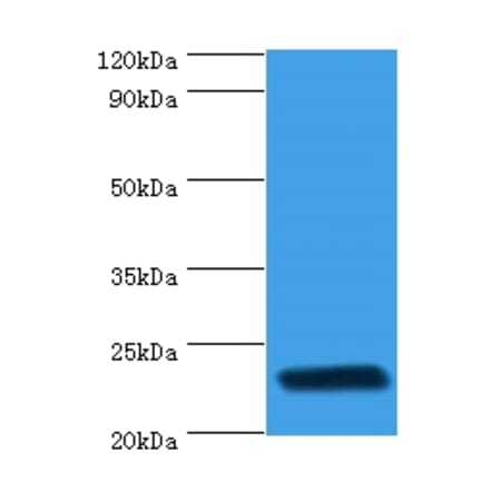 rpiA Polyclonal Antibody from Signalway Antibody (42640) - Antibodies.com