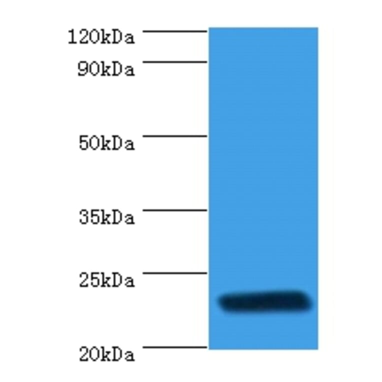 rpiA Polyclonal Antibody from Signalway Antibody (42640) - Antibodies.com