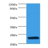 rpiA Polyclonal Antibody from Signalway Antibody (42640) - Antibodies.com