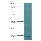 LuxS Polyclonal Antibody from Signalway Antibody (42641) - Antibodies.com