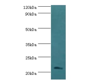 SSX2 Polyclonal Antibody from Signalway Antibody (42646) - Antibodies.com