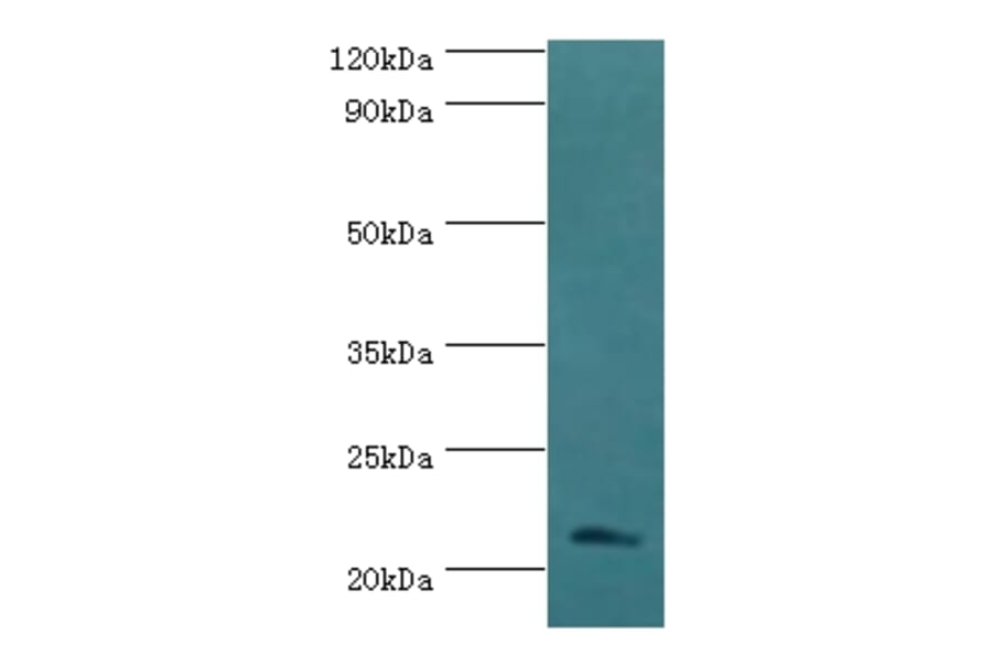 SSX2 Polyclonal Antibody from Signalway Antibody (42646) - Antibodies.com