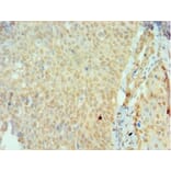 Immunohistochemistry - SSX2 Polyclonal Antibody from Signalway Antibody (42646) - Antibodies.com