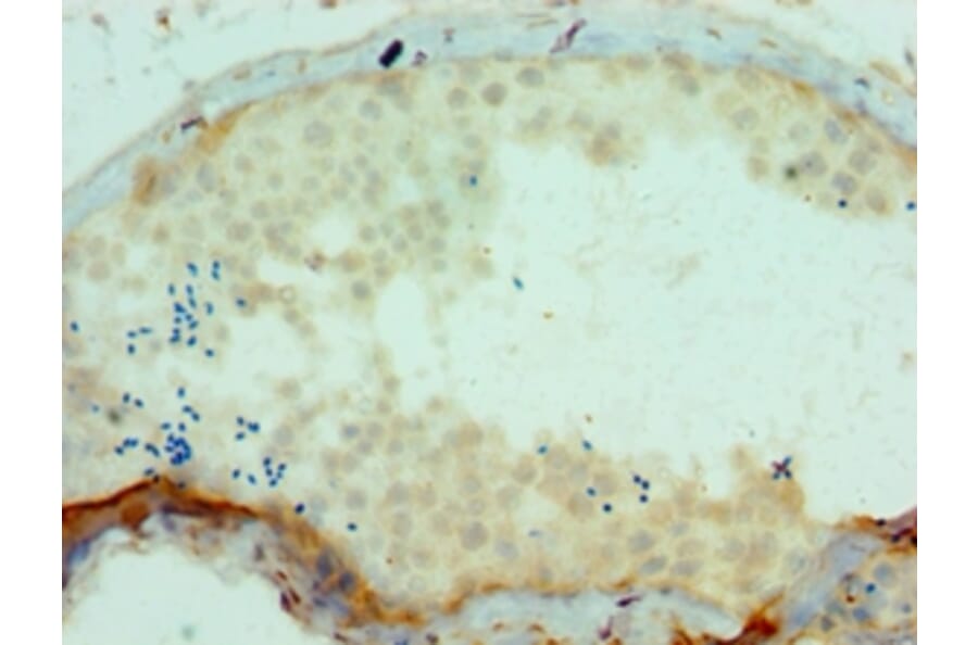 Immunohistochemistry - SSX2 Polyclonal Antibody from Signalway Antibody (42646) - Antibodies.com