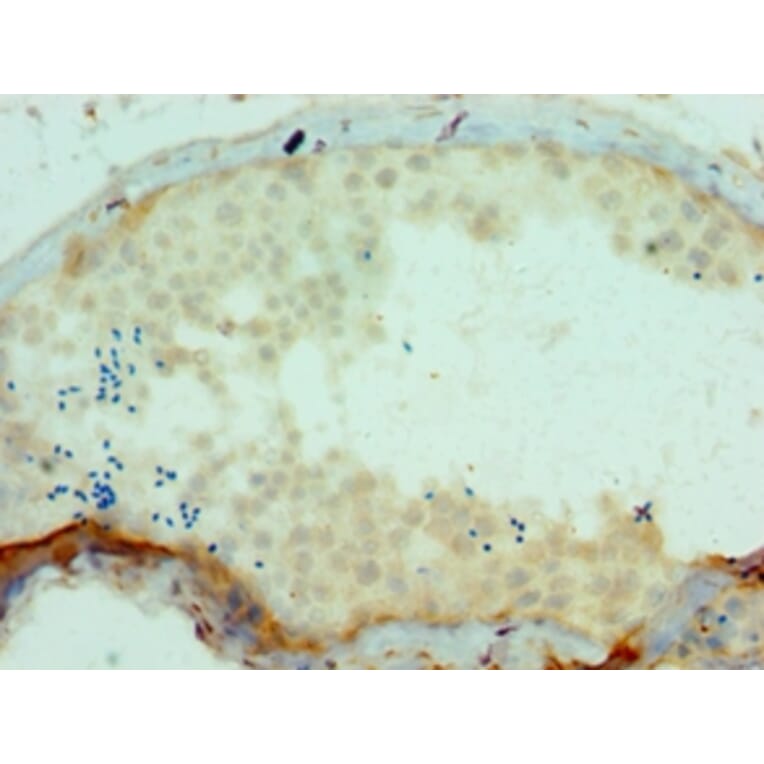Immunohistochemistry - SSX2 Polyclonal Antibody from Signalway Antibody (42646) - Antibodies.com