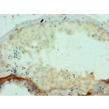 Immunohistochemistry - SSX2 Polyclonal Antibody from Signalway Antibody (42646) - Antibodies.com
