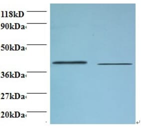 Beta-1,4-galactosyltransferase 3 Polyclonal Antibody from Signalway Antibody (42150) - Antibodies.com
