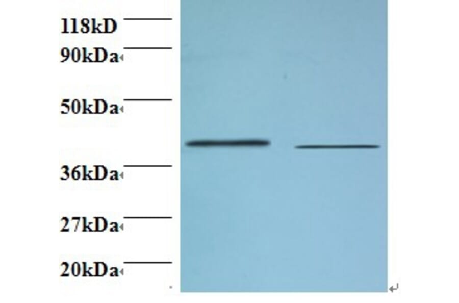 Beta-1,4-galactosyltransferase 3 Polyclonal Antibody from Signalway Antibody (42150) - Antibodies.com