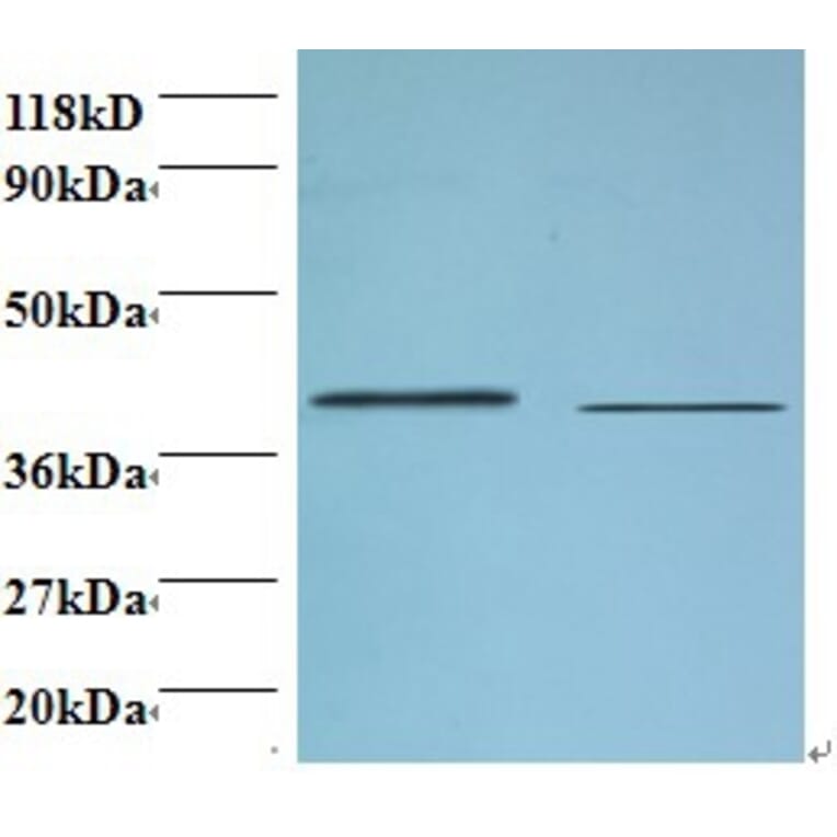 Beta-1,4-galactosyltransferase 3 Polyclonal Antibody from Signalway Antibody (42150) - Antibodies.com