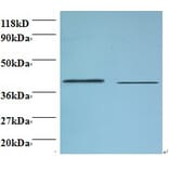 Beta-1,4-galactosyltransferase 3 Polyclonal Antibody from Signalway Antibody (42150) - Antibodies.com