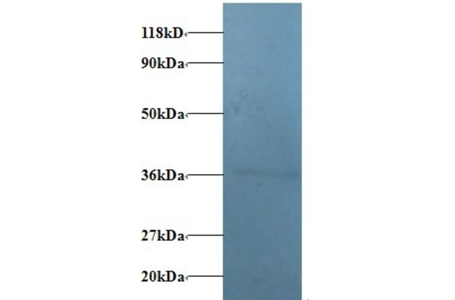 V-type proton ATPase subunit E 1 Polyclonal Antibody from Signalway Antibody (42338) - Antibodies.com