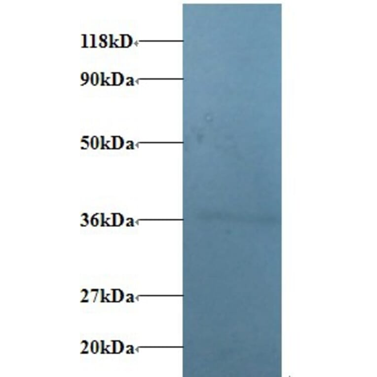 V-type proton ATPase subunit E 1 Polyclonal Antibody from Signalway Antibody (42338) - Antibodies.com