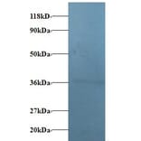 V-type proton ATPase subunit E 1 Polyclonal Antibody from Signalway Antibody (42338) - Antibodies.com