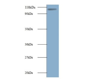 E3 ubiquitin-protein ligase MIB1 Polyclonal Antibody from Signalway Antibody (42567) - Antibodies.com