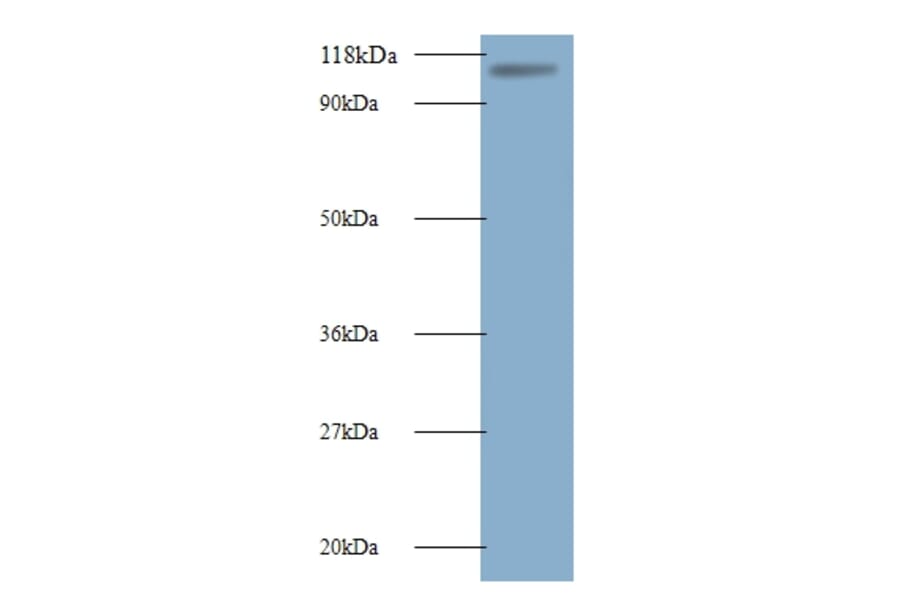 E3 ubiquitin-protein ligase MIB1 Polyclonal Antibody from Signalway Antibody (42567) - Antibodies.com