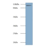 E3 ubiquitin-protein ligase MIB1 Polyclonal Antibody from Signalway Antibody (42567) - Antibodies.com