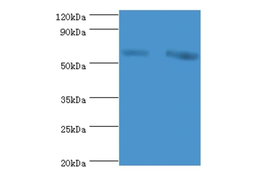 60 kDa SS-A/Ro ribonucleoprotein Polyclonal Antibody from Signalway Antibody (42572) - Antibodies.com