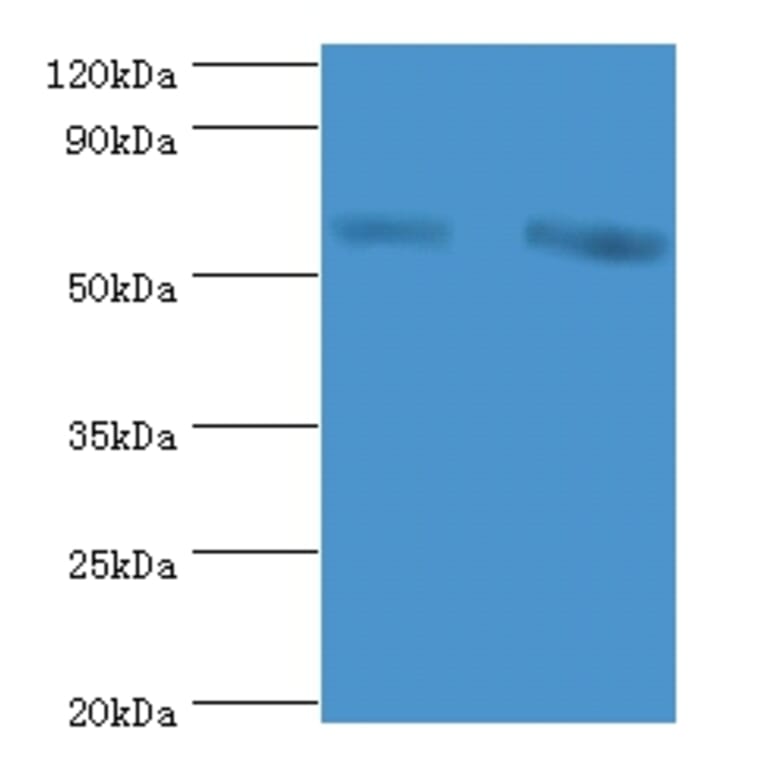 60 kDa SS-A/Ro ribonucleoprotein Polyclonal Antibody from Signalway Antibody (42572) - Antibodies.com