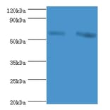 60 kDa SS-A/Ro ribonucleoprotein Polyclonal Antibody from Signalway Antibody (42572) - Antibodies.com