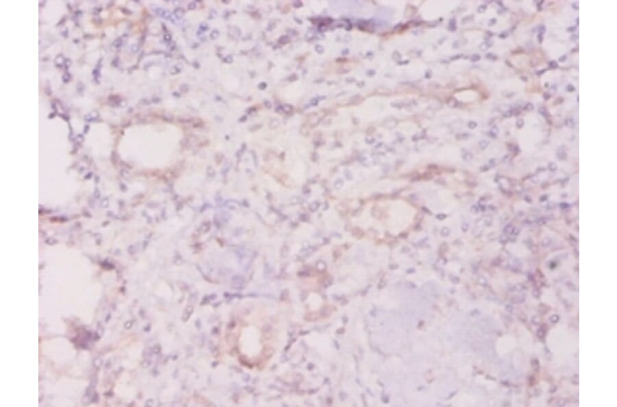 Immunohistochemistry - 60 kDa SS-A/Ro ribonucleoprotein Polyclonal Antibody from Signalway Antibody (42572)