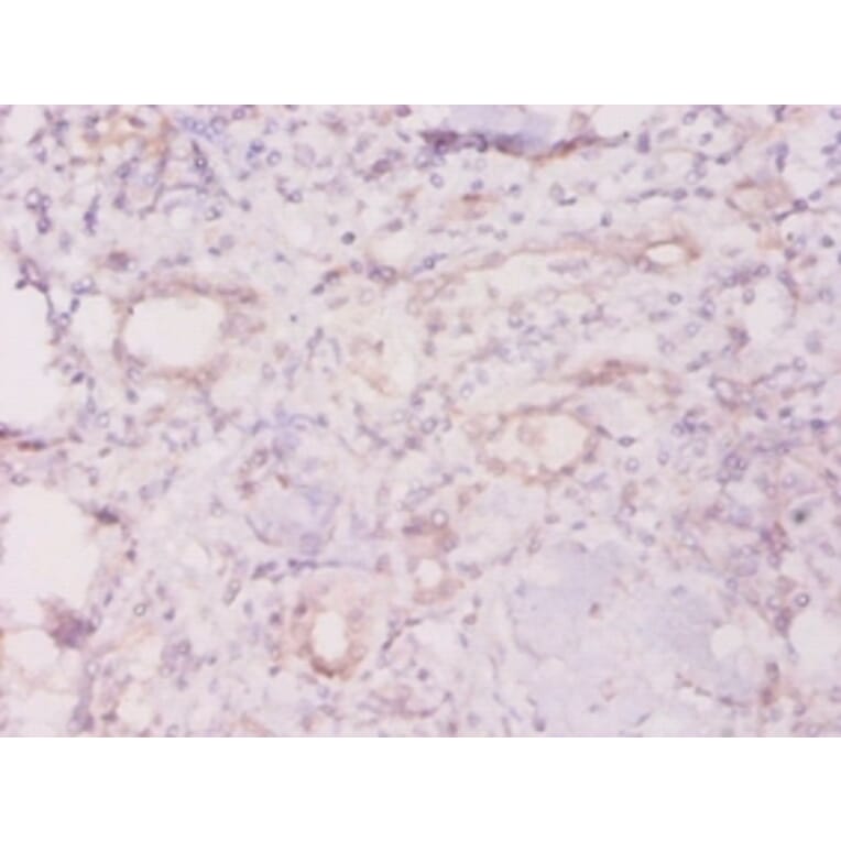 Immunohistochemistry - 60 kDa SS-A/Ro ribonucleoprotein Polyclonal Antibody from Signalway Antibody (42572)