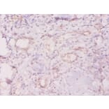 Immunohistochemistry - 60 kDa SS-A/Ro ribonucleoprotein Polyclonal Antibody from Signalway Antibody (42572)