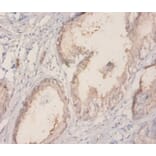 Immunohistochemistry - 60 kDa SS-A/Ro ribonucleoprotein Polyclonal Antibody from Signalway Antibody (42572)