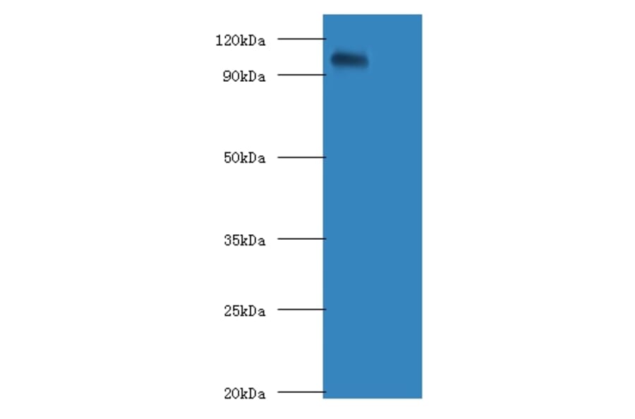 Amyloid beta A4 protein APolyclonal Antibody from Signalway Antibody (42069) - Antibodies.com
