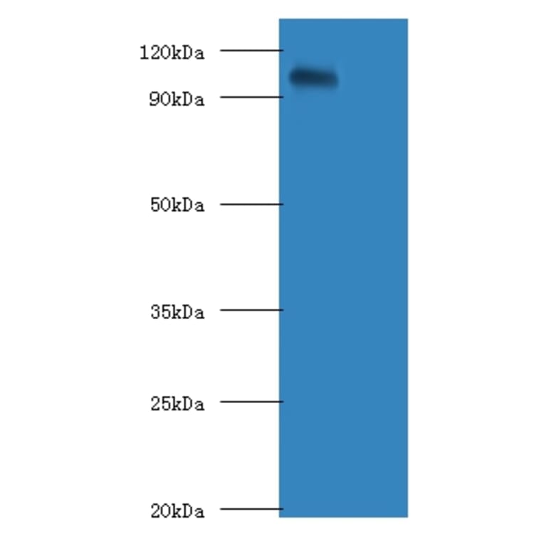 Amyloid beta A4 protein APolyclonal Antibody from Signalway Antibody (42069) - Antibodies.com