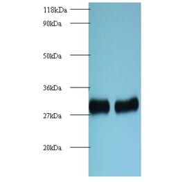 60S ribosomal protein L8 Polyclonal Antibody from Signalway Antibody (42136) - Antibodies.com