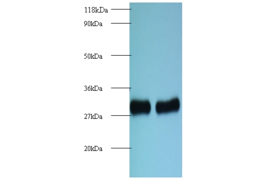 60S ribosomal protein L8 Polyclonal Antibody from Signalway Antibody (42136) - Antibodies.com