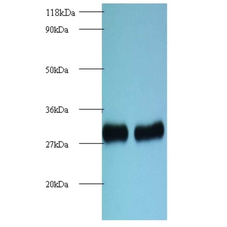 60S ribosomal protein L8 Polyclonal Antibody from Signalway Antibody (42136) - Antibodies.com