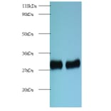 60S ribosomal protein L8 Polyclonal Antibody from Signalway Antibody (42136) - Antibodies.com