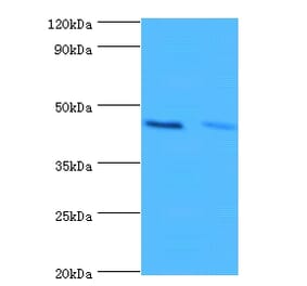 Hemoglobin subunit alpha Polyclonal Antibody from Signalway Antibody (42201) - Antibodies.com