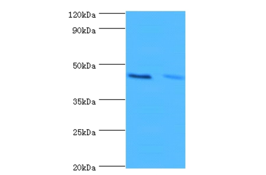 Hemoglobin subunit alpha Polyclonal Antibody from Signalway Antibody (42201) - Antibodies.com