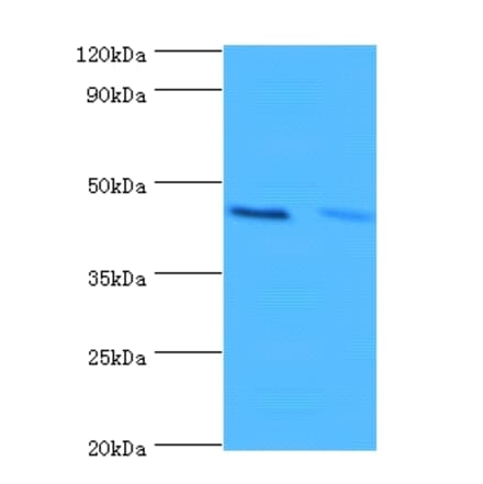 Hemoglobin subunit alpha Polyclonal Antibody from Signalway Antibody (42201) - Antibodies.com