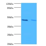 Hemoglobin subunit alpha Polyclonal Antibody from Signalway Antibody (42201) - Antibodies.com