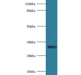 40S ribosomal protein SA Polyclonal Antibody from Signalway Antibody (42314) - Antibodies.com