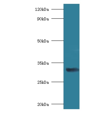 40S ribosomal protein SA Polyclonal Antibody from Signalway Antibody (42314) - Antibodies.com