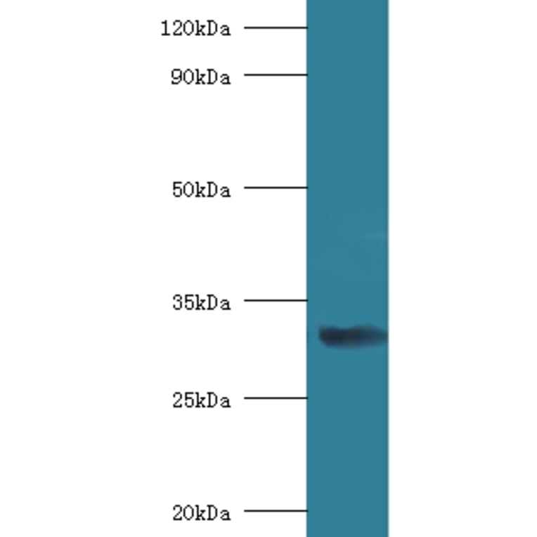 40S ribosomal protein SA Polyclonal Antibody from Signalway Antibody (42314) - Antibodies.com