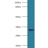 40S ribosomal protein SA Polyclonal Antibody from Signalway Antibody (42314) - Antibodies.com