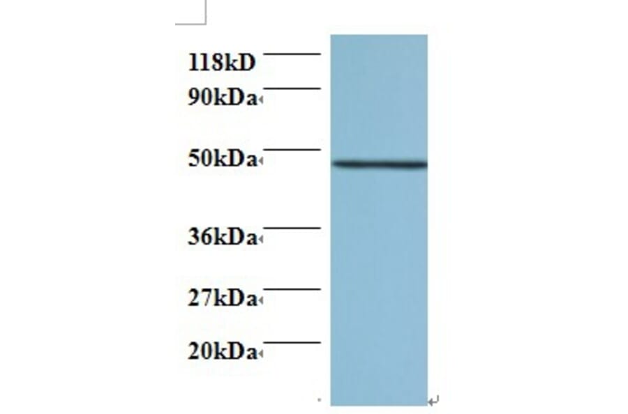 Protein canopy homolog 2 Polyclonal Antibody from Signalway Antibody (42421) - Antibodies.com