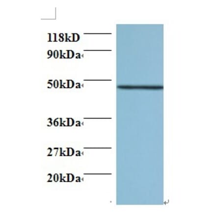 Protein canopy homolog 2 Polyclonal Antibody from Signalway Antibody (42421) - Antibodies.com