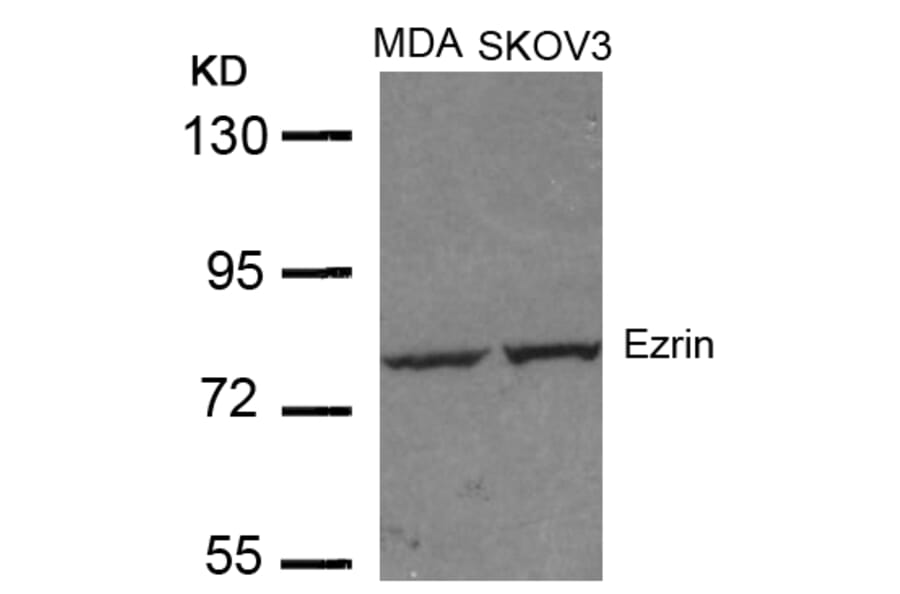 Western blot - Ezrin (Ab-353) Antibody from Signalway Antibody (21094) - Antibodies.com