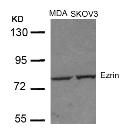 Western blot - Ezrin (Ab-353) Antibody from Signalway Antibody (21094) - Antibodies.com