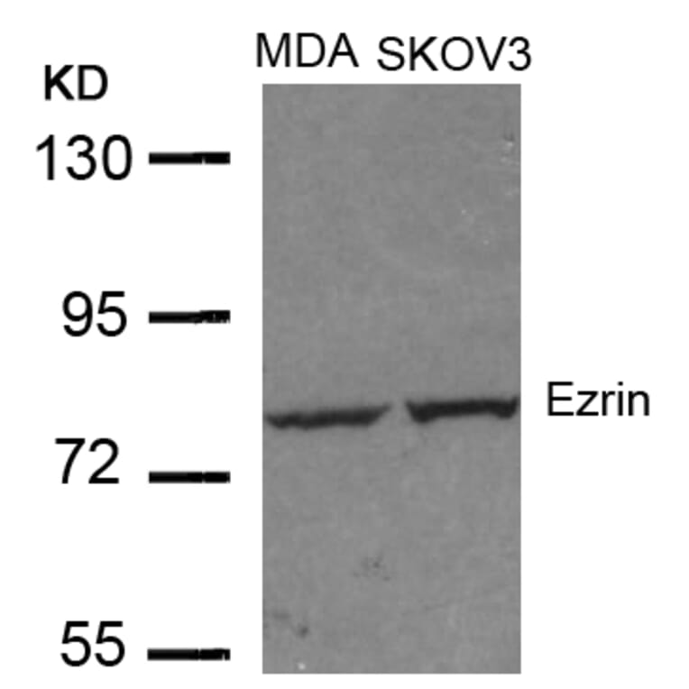 Western blot - Ezrin (Ab-353) Antibody from Signalway Antibody (21094) - Antibodies.com