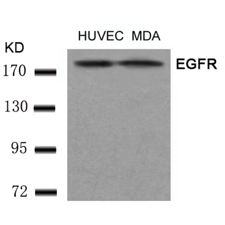 Western blot - EGFR (Ab-1197) Antibody from Signalway Antibody (21221) - Antibodies.com