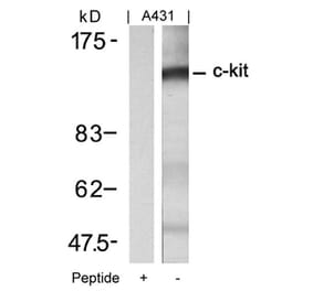 Western blot - c-Kit (Ab-721) Antibody from Signalway Antibody (21232) - Antibodies.com